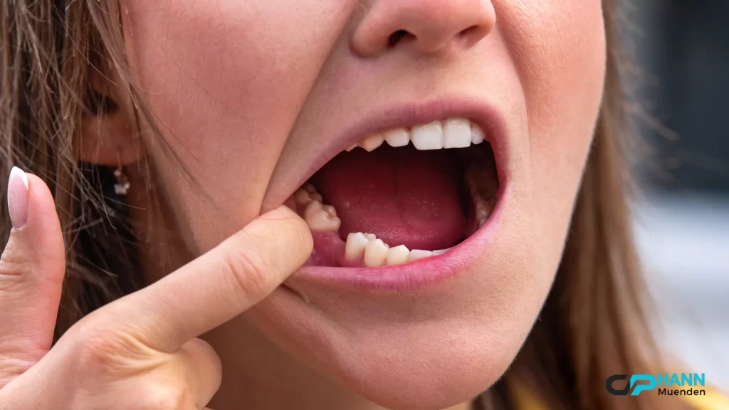 A patient points to an infected tooth, emphasizing the importance of early intervention. How long until a tooth infection kills you?